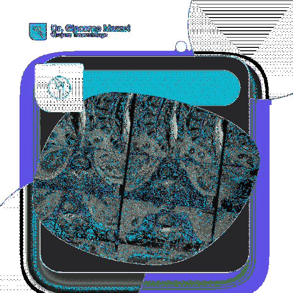 que es bursitis de cadera