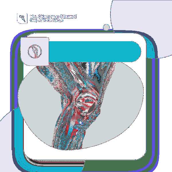 dolor al flexionar la rodilla